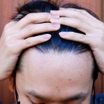 Exploring the Role of Biotin and Collagen in Preventing Hair Loss hair loss